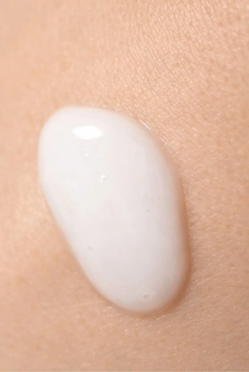 The Acne Starter Kit for Sensitive Skin - Image 3